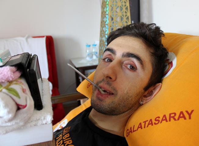 Yatağa bağlı kalsa da pes etmedi Çektiği videolarla fenomen oldu