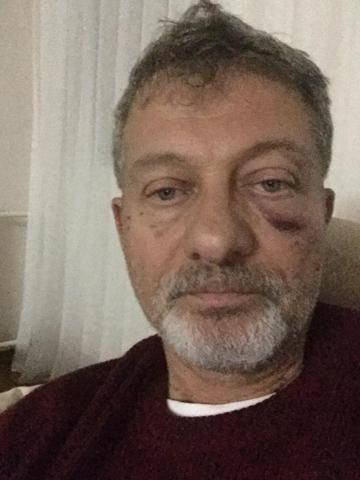 Sağlık raporu vermeyen doktora kafa attı