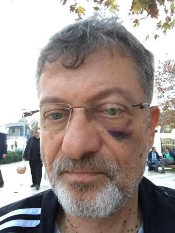 Sağlık raporu vermeyen doktora kafa attı