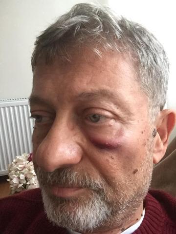 Sağlık raporu vermeyen doktora kafa attı