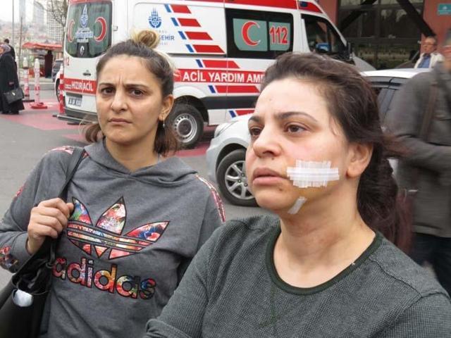 Boşanma aşamasındaki eşini bıçakladı