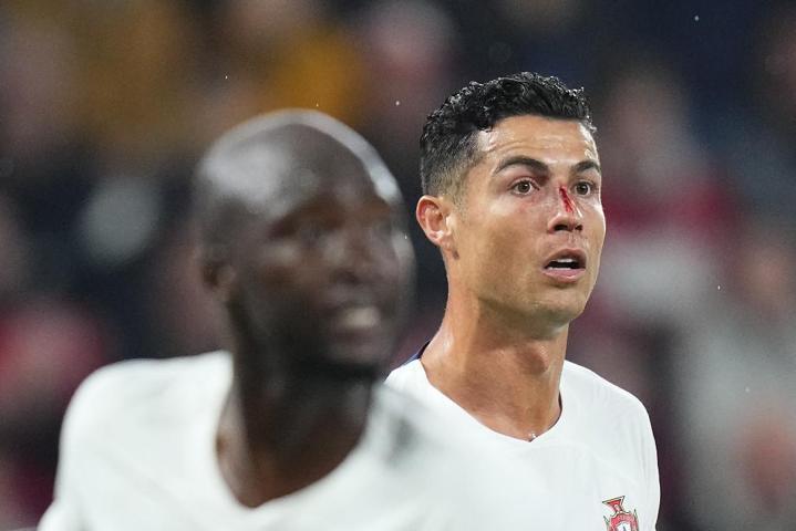 Çekya-Portekiz maçında Cristiano Ronaldo kanlar içinde kaldı