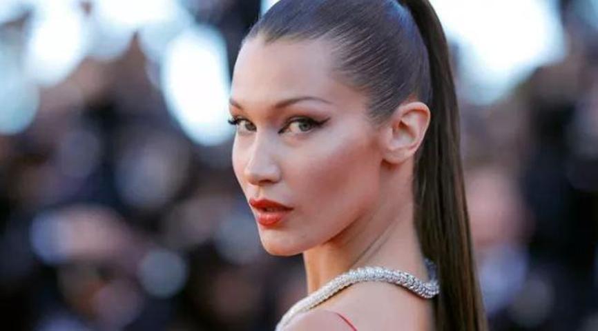 Bella Hadidin hastalığı yüzünden vücudu morardı