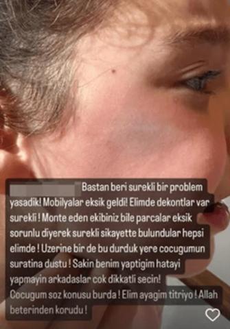 Berkay ve Özlem Ada Şahinin kızının yüzüne dolap kapağı düştü