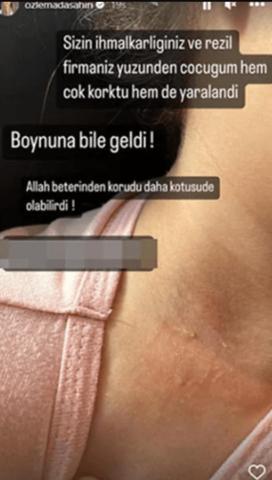 Berkay ve Özlem Ada Şahinin kızının yüzüne dolap kapağı düştü