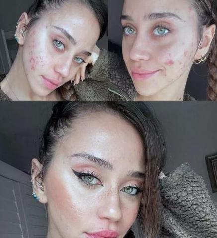 Zeynep Alkan, makyajlı ve makyajsız halini sevenleriyle paylaştı
