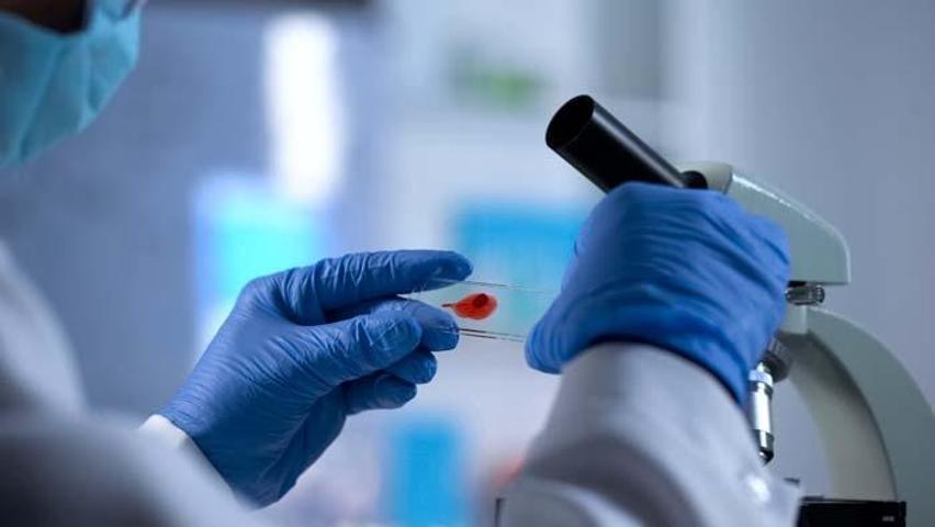 Uzman isim uyardı: HIV virüsü bağışıklığı düşürdüğü için Tüberküloz mikrobu aktif hale geliyor