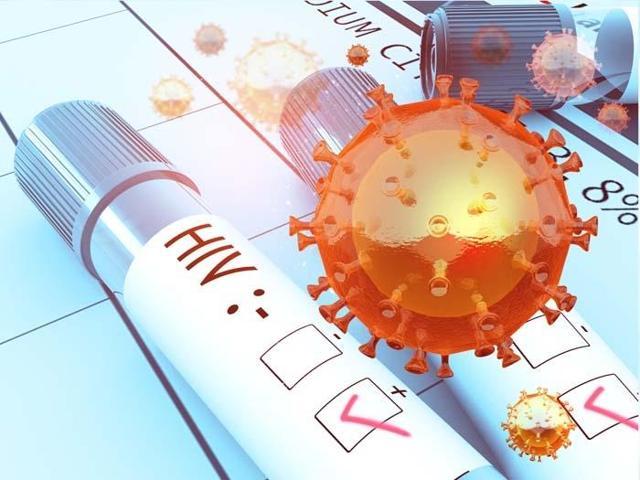 Uzman isim uyardı: HIV virüsü bağışıklığı düşürdüğü için Tüberküloz mikrobu aktif hale geliyor