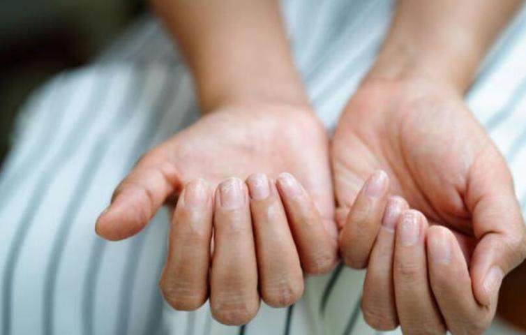 Kanserin en erken belirtisi olabilir Bu sinyalleri dikkate alın