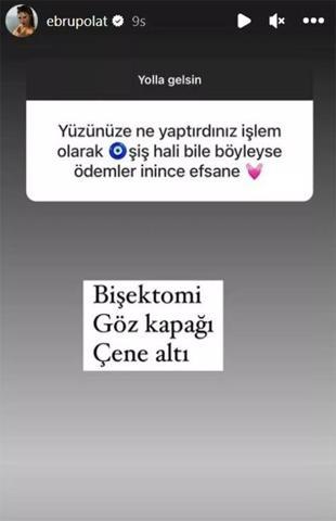Ebru Polat yaptırdığı estetikleri saydı