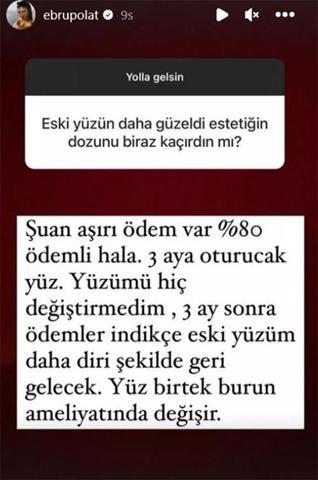 Ebru Polat yaptırdığı estetikleri saydı