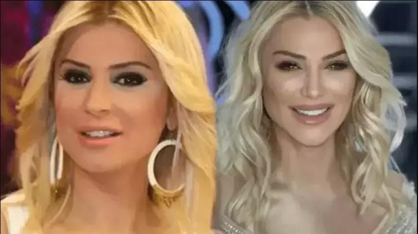 Songül Karlı estetikle bambaşka biri oldu