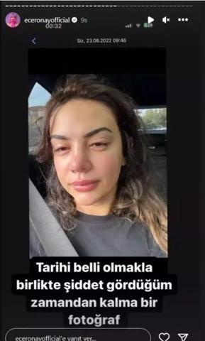 Ece Ronay şiddet gördüğünü açıkladı Artık katlanamıyorum