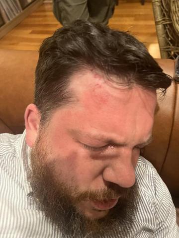 Navalniye yakın isimlerden Leonid Volkov, Litvanyada saldırıya uğradı