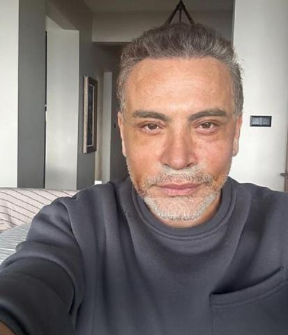 Beğeni butonu çöktü Cenk Eren de estetikli ünlüler kervanına katıldı