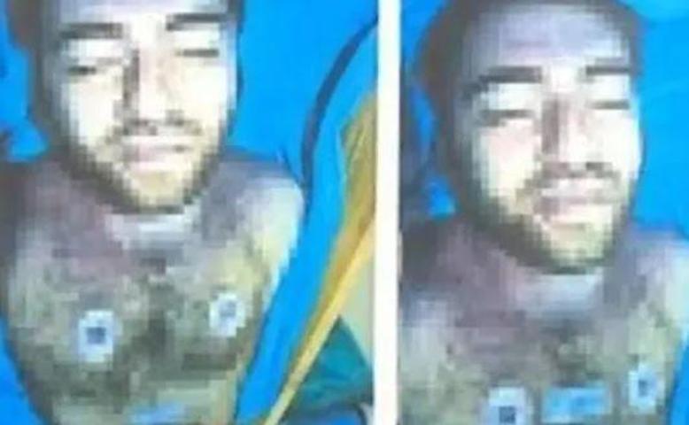 SON DAKİKA Cem Garipoğlunun otopsi fotoğrafında dikkat çekmişti Mor lekenin sırrı ne
