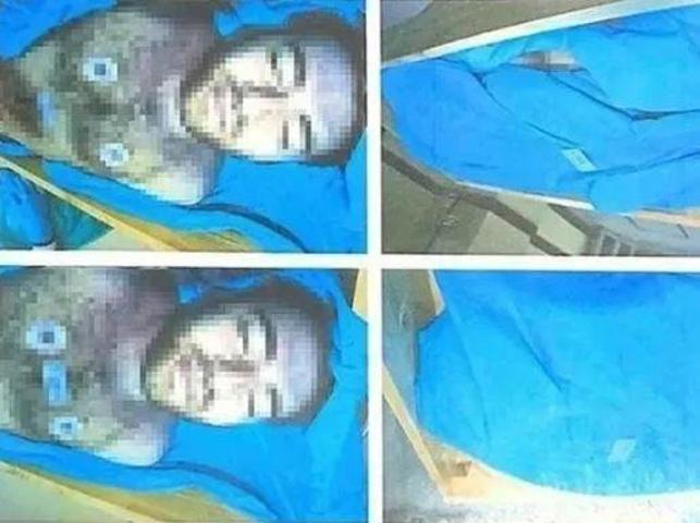SON DAKİKA Cem Garipoğlunun otopsi fotoğrafında dikkat çekmişti Mor lekenin sırrı ne