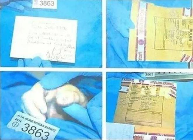 SON DAKİKA Cem Garipoğlunun otopsi fotoğrafında dikkat çekmişti Mor lekenin sırrı ne
