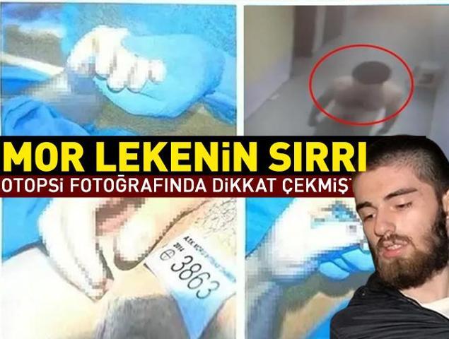 SON DAKİKA Cem Garipoğlunun otopsi fotoğrafında dikkat çekmişti Mor lekenin sırrı ne