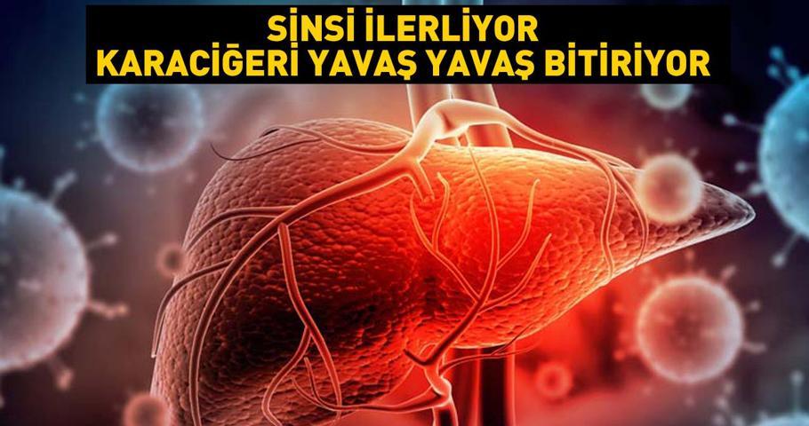 Sinsi ilerliyor, karaciğeri yavaş yavaş bitiriyor Bu besinleri tükettikçe karaciğeriniz yağlanıyor...