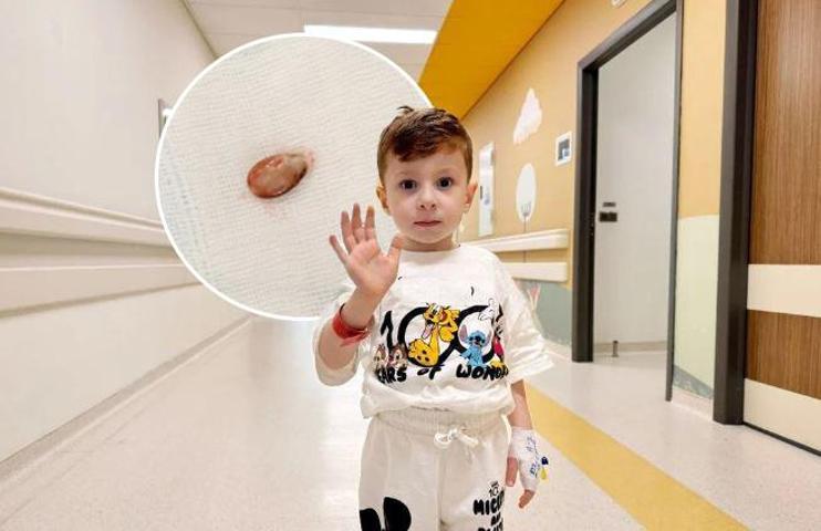 Doktorlar şaştı kaldı  3 yıl boyunca zatürre ve astım tedavisi gördü Meğer sebebi karpuz çekirdeğiymiş