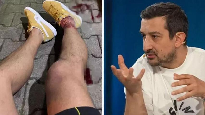 HABER || Serhat Akına silahlı saldırı Dikkat çeken açıklama: Escobar tekniği