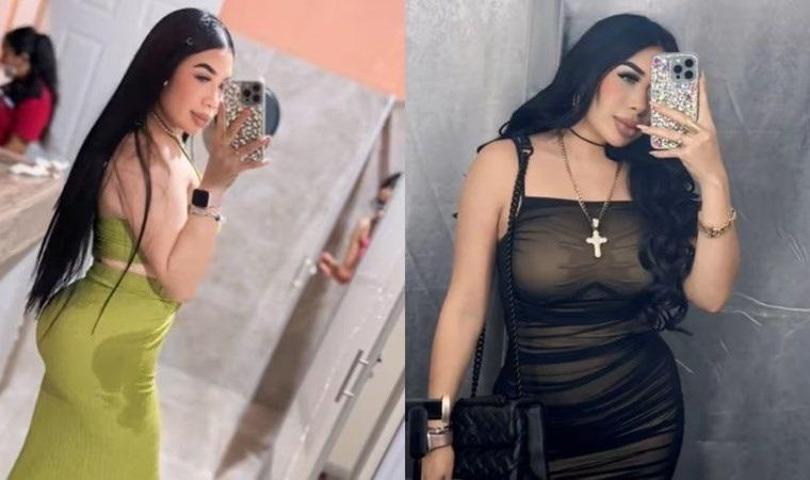 Fazla kilolarından kurtulmak isterken canından oldu Liposuction yaptıran TikTok fenomeni hayatını kaybetti
