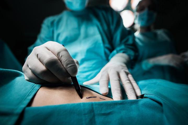 Fazla kilolarından kurtulmak isterken canından oldu Liposuction yaptıran TikTok fenomeni hayatını kaybetti
