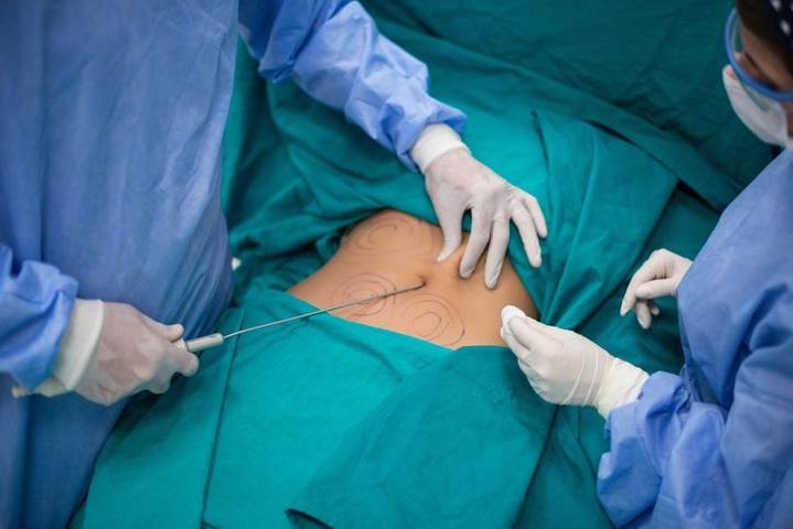 Fazla kilolarından kurtulmak isterken canından oldu Liposuction yaptıran TikTok fenomeni hayatını kaybetti