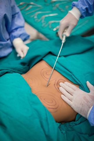 Fazla kilolarından kurtulmak isterken canından oldu Liposuction yaptıran TikTok fenomeni hayatını kaybetti