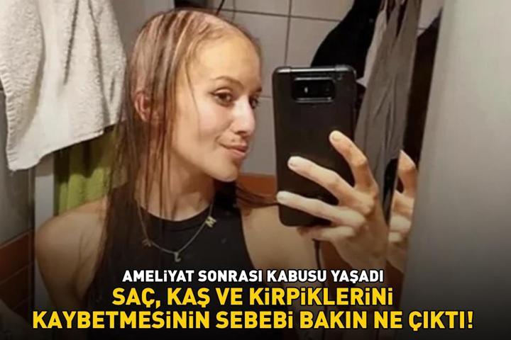 Güzelleşmek için bıçak altına yattı, ameliyat sonrası kabusu yaşadı Saç, kaş ve kirpiklerini kaybetmesinin sebebi bakın ne çıktı