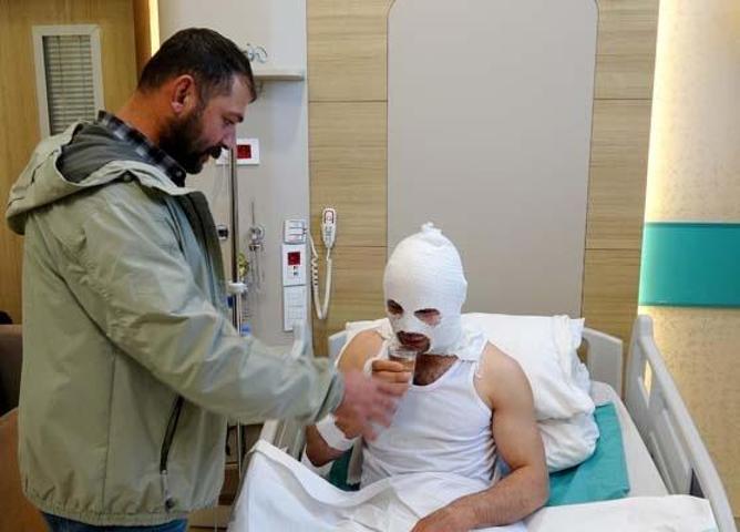 Nişanlısı İçin Hazırladığı Sürpriz, Kabusa Döndü: Sprey Boya Patladı, Hastanelik Oldu