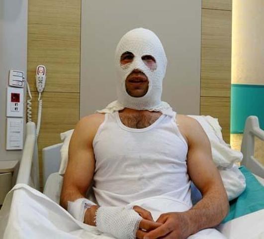 Nişanlısı İçin Hazırladığı Sürpriz, Kabusa Döndü: Sprey Boya Patladı, Hastanelik Oldu
