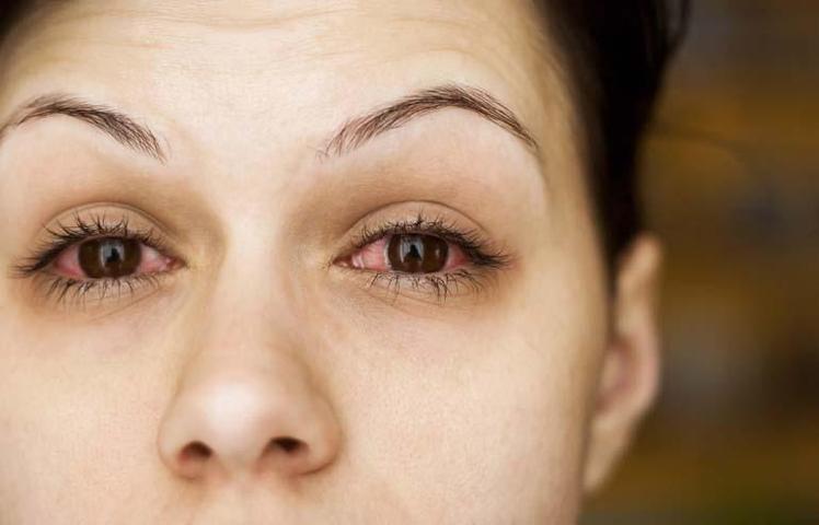 Kimyasallar alerjiye davetiye çıkarıyor