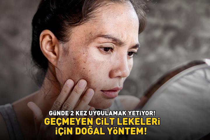 Güneş lekesi ve sivilce izlerini silip süpürüyor Günde 2 kez uygulamak yetiyor