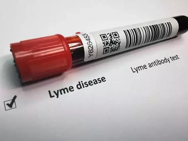 LYME HASTALIĞI BELLA HADİDİN KABUSU OLDU Bu belirtilere dikkat 300 hastalığı taklit ediyor