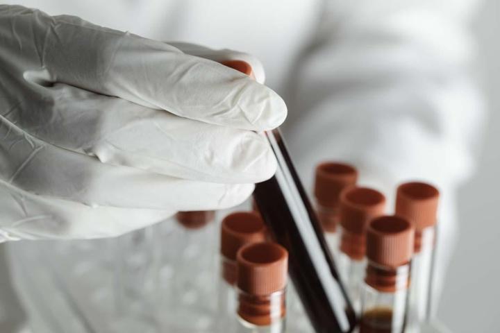Kalp Krizi Riskini 10 Yıl Önceden Tespit Eden Yöntem Yaşınız 40, Böbreğiniz 60 Yaşında Olabilir Akciğer, Damarları ve Kalbi Yaşlandıran 3 Tehlikeye Dikkat Kan Testi ile Biyolojik Yaş Ölçümü