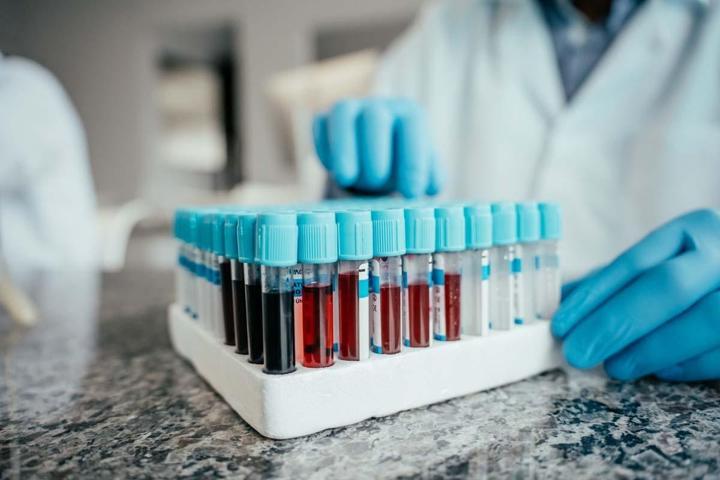 Kalp Krizi Riskini 10 Yıl Önceden Tespit Eden Yöntem Yaşınız 40, Böbreğiniz 60 Yaşında Olabilir Akciğer, Damarları ve Kalbi Yaşlandıran 3 Tehlikeye Dikkat Kan Testi ile Biyolojik Yaş Ölçümü