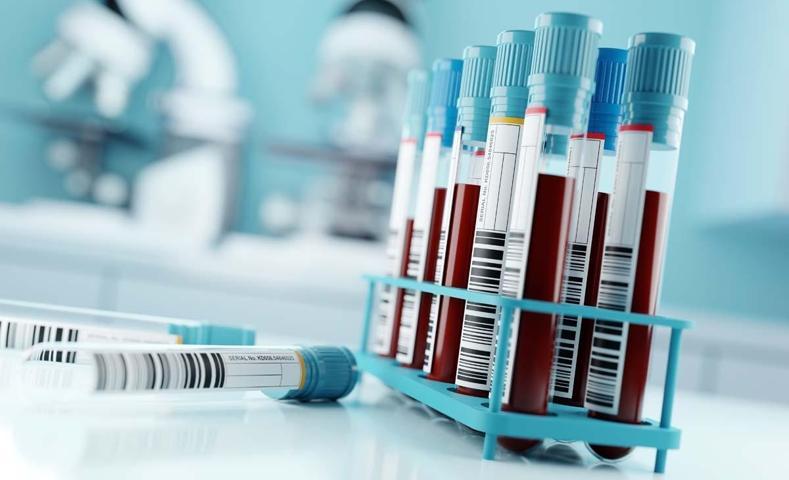 KAN TESTİ İLE TESPİT EDİLEN HASTALIKLAR: Kansızlık, Demir ve B12 Eksikliği, Pıhtı Atması... Basit Bir Kan Sayımı İle Bu Hastalıkları Teşhis Etmek Mümkün
