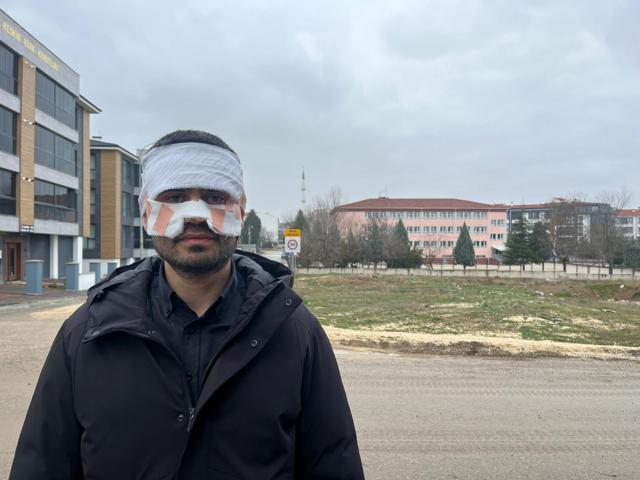 Eskişehirde okulda skandal olay Öğretmen, meslektaşının yüzüne sıcak çay fırlattı