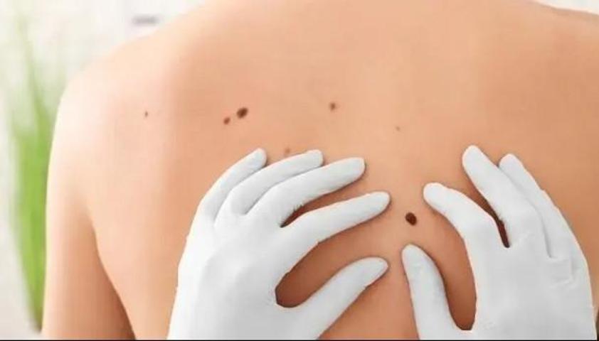 Et benleri metabolik hastalıkların habercisi olabilir