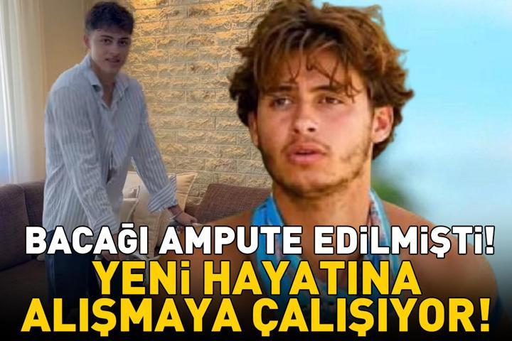 Bacağı ampute edilmişti Survivor Yunanistanın şampiyonu Stavros Floros yeni hayatına alışmaya çalışıyor