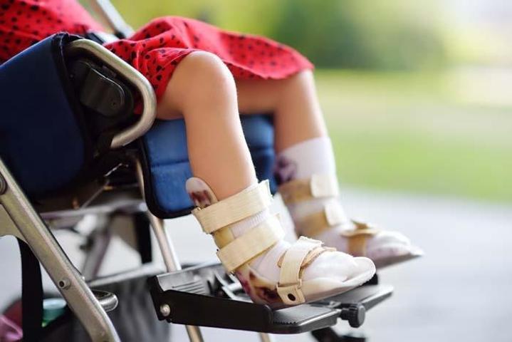 BEYİN FELCİNDE ERKEN TEŞHİS ADIMI: Kan Testi ve Yapay Zeka Birleşiyor Beyin Felci Riskini Doğumdan Hemen Sonra Ortaya Çıkarabilir
