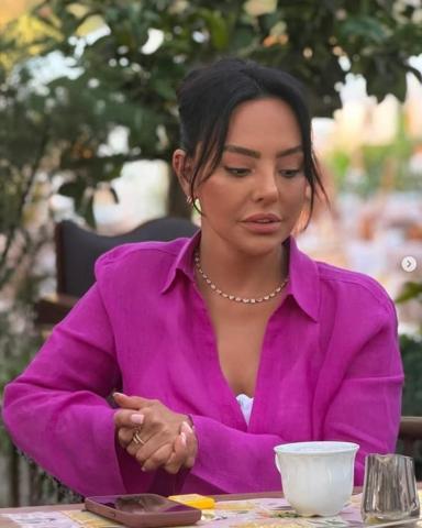 Ebru Gündeş’in Son Hali Gündem Oldu 10 Milyon TL’lik Estetik İddiası Yeniden Konuşuluyor