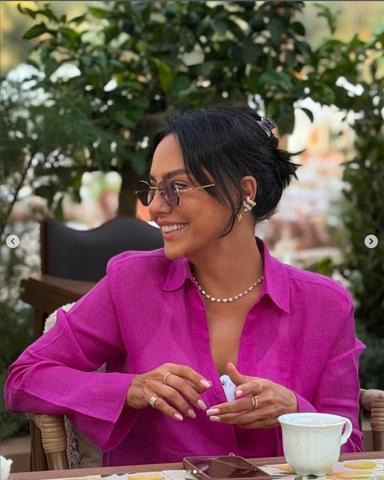 Ebru Gündeş’in Son Hali Gündem Oldu 10 Milyon TL’lik Estetik İddiası Yeniden Konuşuluyor