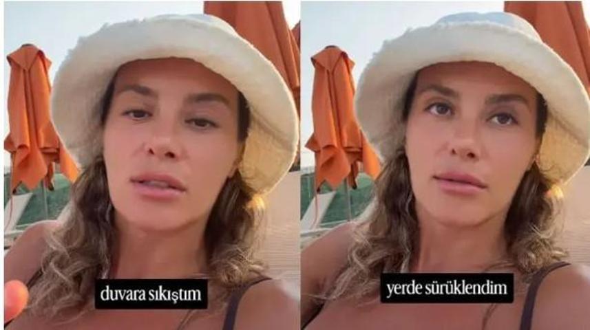 Mihre Mutlu Çeşme’de Köpek Saldırısına Uğradı “Düştüm, Sürüklendim”