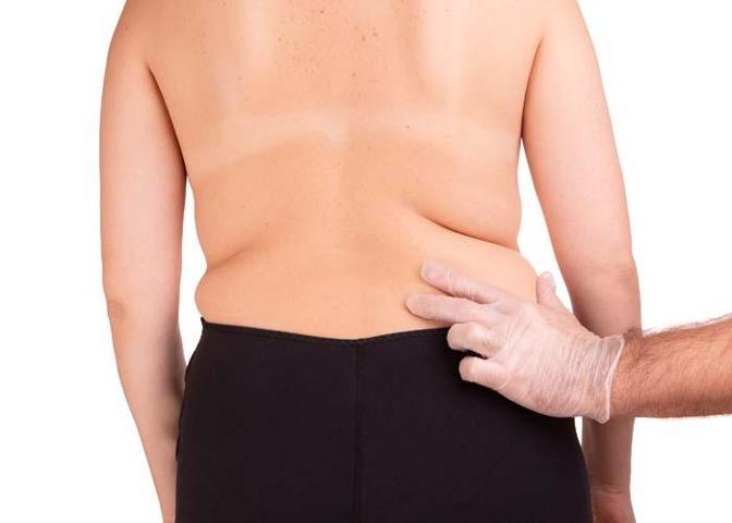 OBEZİTE SANILIYOR AMA DEĞİL Diyet Yapıyor Ama Bacaklarınız Ve Basen Bölgeniz İncelmiyorsa Dikkat Nedeni Bambaşka Olabilir