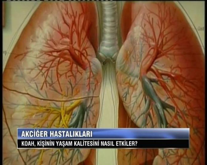 Sinsi tehlike KOAH hastalığında artış