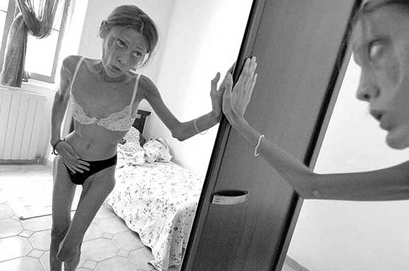 Model Isabelle Caro anoreksiyaya yenildi