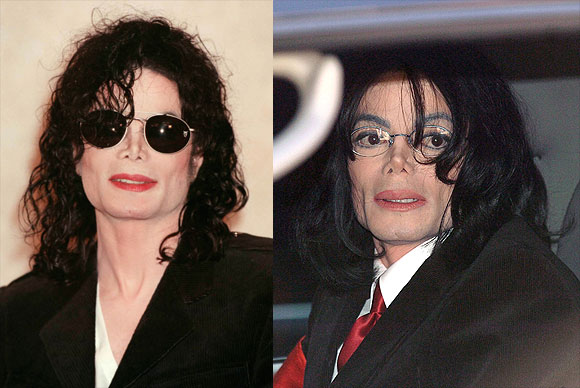 Michael Jackson neden öldü